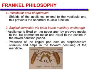 FRANKEL PHILOSOPHY
1.. Vestibular area of operation
- Shields of the appliance extend to the vestibule and
this prevents the abnormal muscle function.
2. Sagittal correction via tooth borne maxillary anchorage
- Appliance is fixed on the upper arch by grooves mesial
to the 1st permanent molar and distal to the canine in
the mixed dentition period.
- Presence of the lingual pad acts as proprioceptive
stimulus and helps in the forward posturing of the
mandible.
 