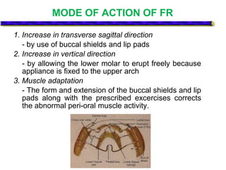 MODE OF ACTION OF FR
1. Increase in transverse sagittal direction
- by use of buccal shields and lip pads
2. Increase in vertical direction
- by allowing the lower molar to erupt freely because
appliance is fixed to the upper arch
3. Muscle adaptation
- The form and extension of the buccal shields and lip
pads along with the prescribed excercises corrects
the abnormal peri-oral muscle activity.
 
