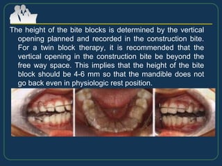 The height of the bite blocks is determined by the vertical
opening planned and recorded in the construction bite.
For a twin block therapy, it is recommended that the
vertical opening in the construction bite be beyond the
free way space. This implies that the height of the bite
block should be 4-6 mm so that the mandible does not
go back even in physiologic rest position.
 