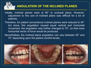 initially, inclined planes were at 90° to occlusal plane. However,
adjustment to this sort of inclined plane was difficult for a lot of
patients.
Therefore, for patient convenience inclined planes were reduced to 45°
but since, this angulation caused equal vertical and horizontal
movement, the angulation was further changed to 70°, so that more
horizontal vector of force would be produced.
Nevertheless, the inclined plane angulation can vary between 45° and
70° depending upon the patient comfort levels.
ANGULATION OF THE INCLINED PLANES
 