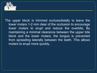 The upper block is trimmed occlusodistally to leave the
lower molars 1-2 mm clear of the occlusion to encourage
lower molars to erupt and reduce the overbite, By
maintaining a minimal clearance between the upper bite
block and the lower molars, the tongue is prevented
from spreading laterally between the teeth. This allows
molars to erupt more quickly.
 