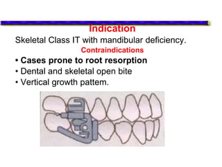Indication
Skeletal Class IT with mandibular deficiency.
Contraindications
• Cases prone to root resorption
• Dental and skeletal open bite
• Vertical growth pattem.
 