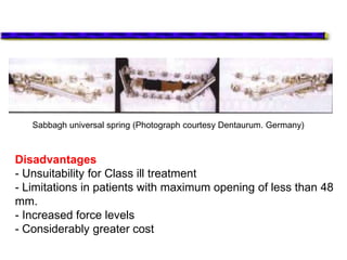 Sabbagh universal spring (Photograph courtesy Dentaurum. Germany)
Disadvantages
- Unsuitability for Class ill treatment
- Limitations in patients with maximum opening of less than 48
mm.
- Increased force levels
- Considerably greater cost
 