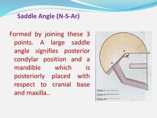 Formed by joining these 3
points. A large saddle
angle signifies posterior
condylar position and a
mandible which is
posteriorly placed with
respect to cranial base
and maxilla..
31
Saddle Angle (N-S-Ar)
 