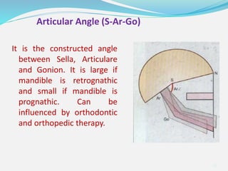 It is the constructed angle
between Sella, Articulare
and Gonion. It is large if
mandible is retrognathic
and small if mandible is
prognathic. Can be
influenced by orthodontic
and orthopedic therapy.
33
Articular Angle (S-Ar-Go)
 