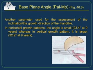 Another parameter used for the assessment of the
inclination/the growth direction of the mandible.
In horizontal growth patterns, the angle is small (23.4° at 9
years) whereas in vertical growth pattern, it is larger
(32.9° at 9 years).
Base Plane Angle (Pal-Mp) (Fig. 46.8)
 