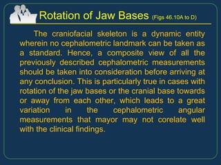 The craniofacial skeleton is a dynamic entity
wherein no cephalometric landmark can be taken as
a standard. Hence, a composite view of all the
previously described cephalometric measurements
should be taken into consideration before arriving at
any conclusion. This is particularly true in cases with
rotation of the jaw bases or the cranial base towards
or away from each other, which leads to a great
variation in the cephalometric angular
measurements that mayor may not corelate well
with the clinical findings.
Rotation of Jaw Bases (Figs 46.10A to D)
 
