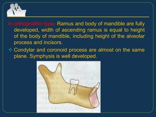 In orthognathic type- Ramus and body of mandible are fully
developed, width of ascending ramus is equal to height
of the body of mandible, including height of the alveolar
process and incisors.
 Condylar and coronoid process are almost on the same
plane. Symphysis is well developed.
 