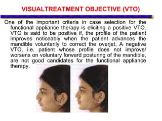 VISUALTREATMENT OBJECTIVE (VTO)
One of the important criteria in case selection for the
functional appliance therapy is eliciting a positive VTO.
VTO is said to be positive if, the profile of the patient
improves noticeably when the patient advances the
mandible voluntarily to correct the overjet. A negative
VTO, i.e. patient whose profile does not improve/
worsens on voluntary forward posturing of the mandible,
are not good candidates for the functional appliance
therapy.
 