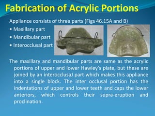 Fabrication of Acrylic Portions
Appliance consists of three parts (Figs 46.15A and B)
• Maxillary part
• Mandibular part
• lnterocclusal part
The maxillary and mandibular parts are same as the acrylic
portions of upper and lower Hawley's plate, but these are
joined by an interocclusaJ part which makes this appliance
into a single block. The inter occlusal portion has the
indentations of upper and lower teeth and caps the lower
anteriors, which controls their supra-eruption and
proclination.
 