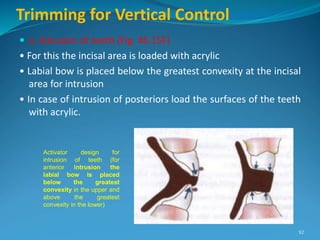 Trimming for Vertical Control
 a. lntrusion of teeth (Fig. 46.15F)
• For this the incisal area is loaded with acrylic
• Labial bow is placed below the greatest convexity at the incisal
area for intrusion
• In case of intrusion of posteriors load the surfaces of the teeth
with acrylic.
92
Activator design for
intrusion of teeth (for
anterior intrusion the
labial bow is placed
below the greatest
convexity in the upper and
above the greatest
convexity in the lower)
 