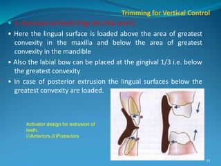  b. Extrusion of teeth (Figs 46.15Gi and ii)
• Here the lingual surface is loaded above the area of greatest
convexity in the maxilla and below the area of greatest
convexity in the mandible
• Also the labial bow can be placed at the gingival 1/3 i.e. below
the greatest convexity
• In case of posterior extrusion the lingual surfaces below the
greatest convexity are loaded.
93
Trimming for Vertical Control
Activator design for extrusion of
teeth.
(i)Anteriors.(ii)Posteriors
 