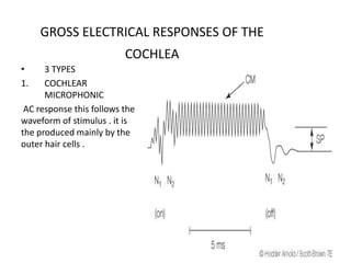 Cochlear Microphonics Examples Functional aspects of cochlea | PPT