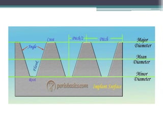 Functional basis of dental implants