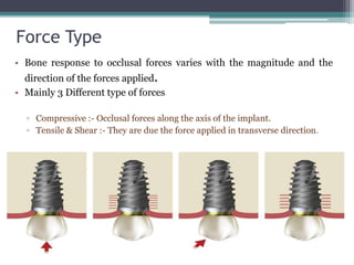 Functional basis of dental implants