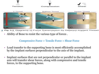 Functional basis of dental implants