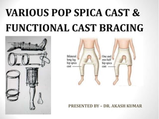 VARIOUS POP SPICA CAST &
FUNCTIONAL CAST BRACING
PRESENTED BY –DR. AKASH KUMAR
PRESENTED BY – DR. AKASH KUMAR
 
