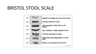 BRISTOL STOOL SCALE
 
