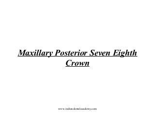 Maxillary Posterior Seven Eighth
Crown

www.indiandentalacademy.com

 