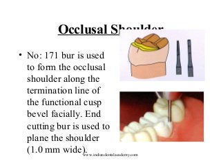 Occlusal Shoulder
• No: 171 bur is used
to form the occlusal
shoulder along the
termination line of
the functional cusp
bevel facially. End
cutting bur is used to
plane the shoulder
(1.0 mm wide).
www.indiandentalacademy.com

 