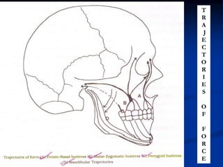 T
R
A
J
E
C
T
O
R
I
E
S
O
F
F
O
R
C
E
 