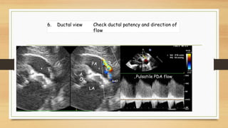 Functional echocardiography ppt | PDF