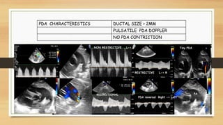 Functional echocardiography ppt | PDF