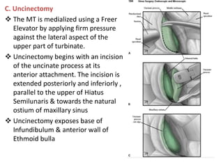 C. Uncinectomy
 The MT is medialized using a Freer
Elevator by applying firm pressure
against the lateral aspect of the
upper part of turbinate.
 Uncinectomy begins with an incision
of the uncinate process at its
anterior attachment. The incision is
extended posteriorly and inferiorly ,
parallel to the upper of Hiatus
Semilunaris & towards the natural
ostium of maxillary sinus
 Uncinectomy exposes base of
Infundibulum & anterior wall of
Ethmoid bulla
 
