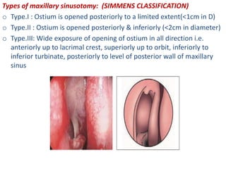 Types of maxillary sinusotomy: (SIMMENS CLASSIFICATION)
o Type.I : Ostium is opened posteriorly to a limited extent(<1cm in D)
o Type.II : Ostium is opened posteriorly & inferiorly (<2cm in diameter)
o Type.III: Wide exposure of opening of ostium in all direction i.e.
anteriorly up to lacrimal crest, superiorly up to orbit, inferiorly to
inferior turbinate, posteriorly to level of posterior wall of maxillary
sinus
 
