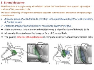 E. Ethmoidectomy
Maxillary sinus is a single cavity with distinct ostium but the ethmoid sinus consists of multiple
cavities of interconnected cells.
The basal lamella of MT separates ethmoid labyrinth to two distinct anatomical and physiologic
compartment.
 Anterior group of cells drains its secretion into infundibulum together with maxillary
& frontal sinuses
 Posterior group of cells drains their mucus into superior meatus
 Main anatomical landmark for ethmoidectomy is identification of Ethmoid Bulla
 Mucosa is dissected over the bony surface of Ethmoid Bulla
 The goal of anterior ethmoidectomy is complete exposure of anterior ethmoid cells
 