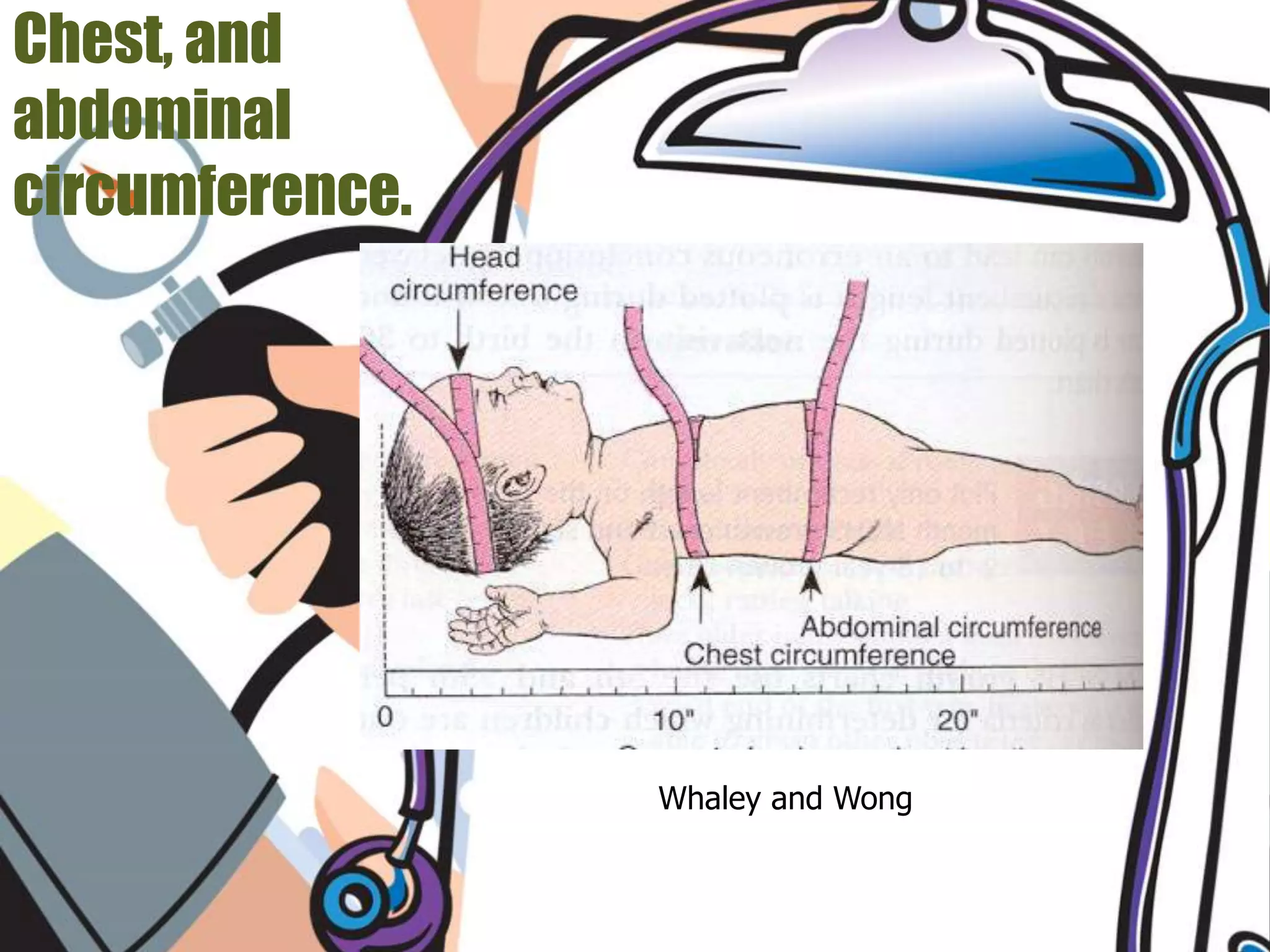 Chest, and
abdominal
circumference.
Whaley and Wong
 