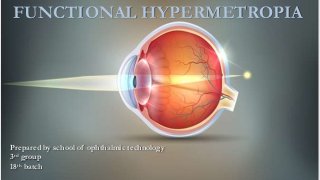 Prepared by school of ophthalmic technology
3rd group
18th batch
FUNCTIONAL HYPERMETROPIA
 