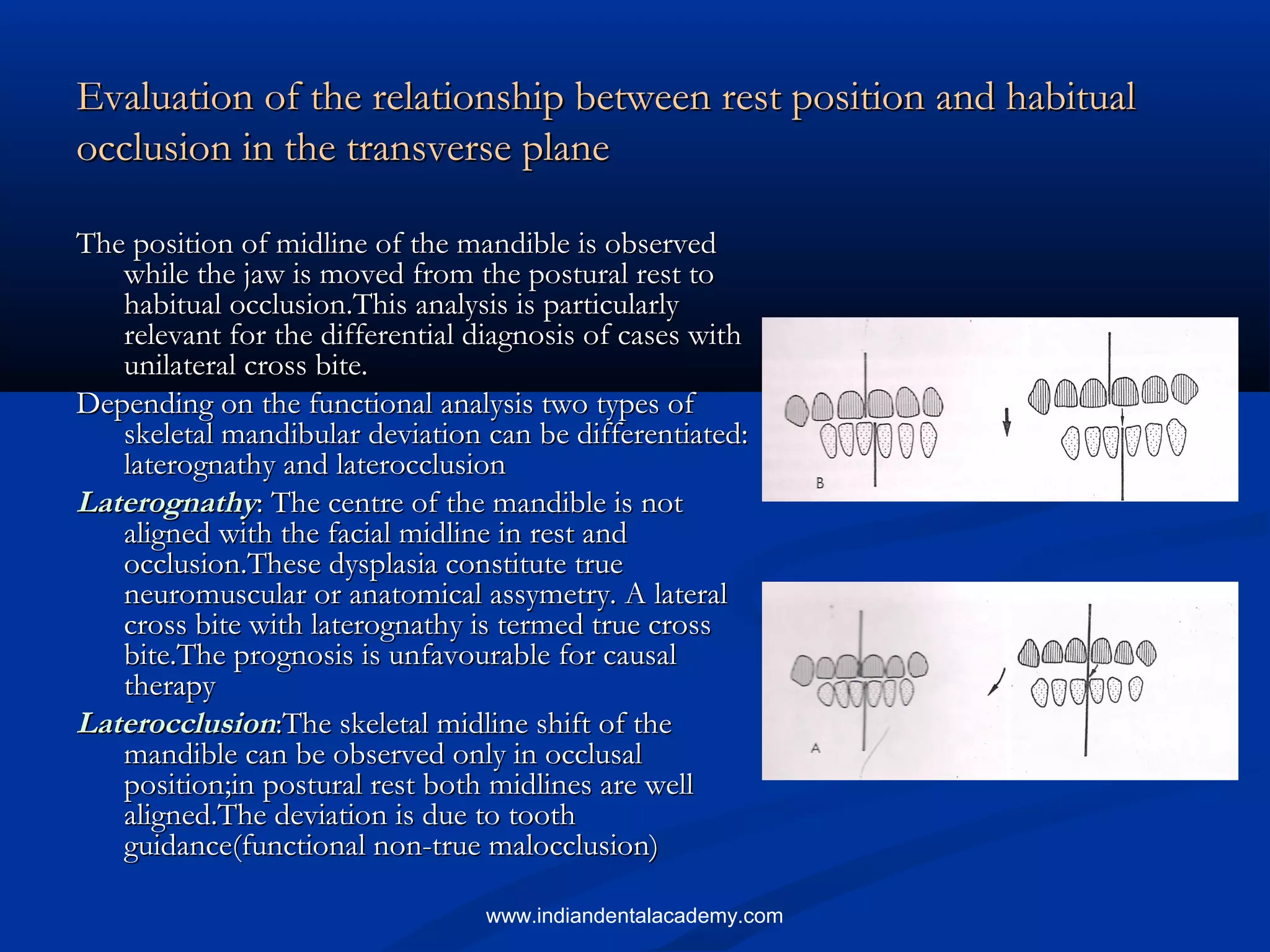 Evaluation of the relationship between rest position and habitualEvaluation of the relationship between rest position and habitual
occlusion in the transverse planeocclusion in the transverse plane
The position of midline of the mandible is observedThe position of midline of the mandible is observed
while the jaw is moved from the postural rest towhile the jaw is moved from the postural rest to
habitual occlusion.This analysis is particularlyhabitual occlusion.This analysis is particularly
relevant for the differential diagnosis of cases withrelevant for the differential diagnosis of cases with
unilateral cross bite.unilateral cross bite.
Depending on the functional analysis two types ofDepending on the functional analysis two types of
skeletal mandibular deviation can be differentiated:skeletal mandibular deviation can be differentiated:
laterognathy and laterocclusionlaterognathy and laterocclusion
LaterognathyLaterognathy: The centre of the mandible is not: The centre of the mandible is not
aligned with the facial midline in rest andaligned with the facial midline in rest and
occlusion.These dysplasia constitute trueocclusion.These dysplasia constitute true
neuromuscular or anatomical assymetry. A lateralneuromuscular or anatomical assymetry. A lateral
cross bite with laterognathy is termed true crosscross bite with laterognathy is termed true cross
bite.The prognosis is unfavourable for causalbite.The prognosis is unfavourable for causal
therapytherapy
LaterocclusionLaterocclusion:The skeletal midline shift of the:The skeletal midline shift of the
mandible can be observed only in occlusalmandible can be observed only in occlusal
position;in postural rest both midlines are wellposition;in postural rest both midlines are well
aligned.The deviation is due to toothaligned.The deviation is due to tooth
guidance(functional non-true malocclusion)guidance(functional non-true malocclusion)
www.indiandentalacademy.com
 