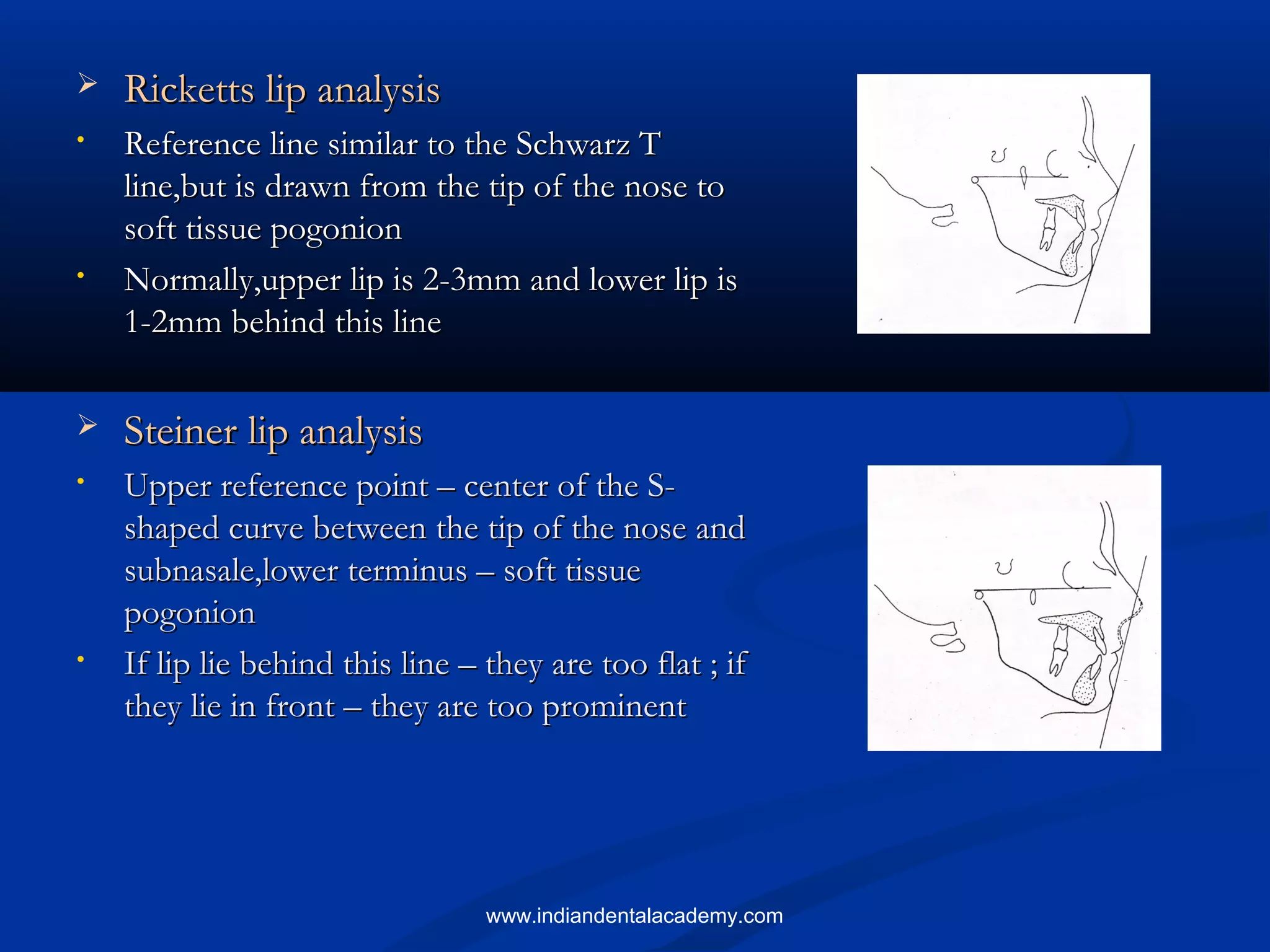  Ricketts lip analysisRicketts lip analysis
• Reference line similar to the Schwarz TReference line similar to the Schwarz T
line,but is drawn from the tip of the nose toline,but is drawn from the tip of the nose to
soft tissue pogonionsoft tissue pogonion
• Normally,upper lip is 2-3mm and lower lip isNormally,upper lip is 2-3mm and lower lip is
1-2mm behind this line1-2mm behind this line
 Steiner lip analysisSteiner lip analysis
• Upper reference point – center of the S-Upper reference point – center of the S-
shaped curve between the tip of the nose andshaped curve between the tip of the nose and
subnasale,lower terminus – soft tissuesubnasale,lower terminus – soft tissue
pogonionpogonion
• If lip lie behind this line – they are too flat ; ifIf lip lie behind this line – they are too flat ; if
they lie in front – they are too prominentthey lie in front – they are too prominent
www.indiandentalacademy.com
 
