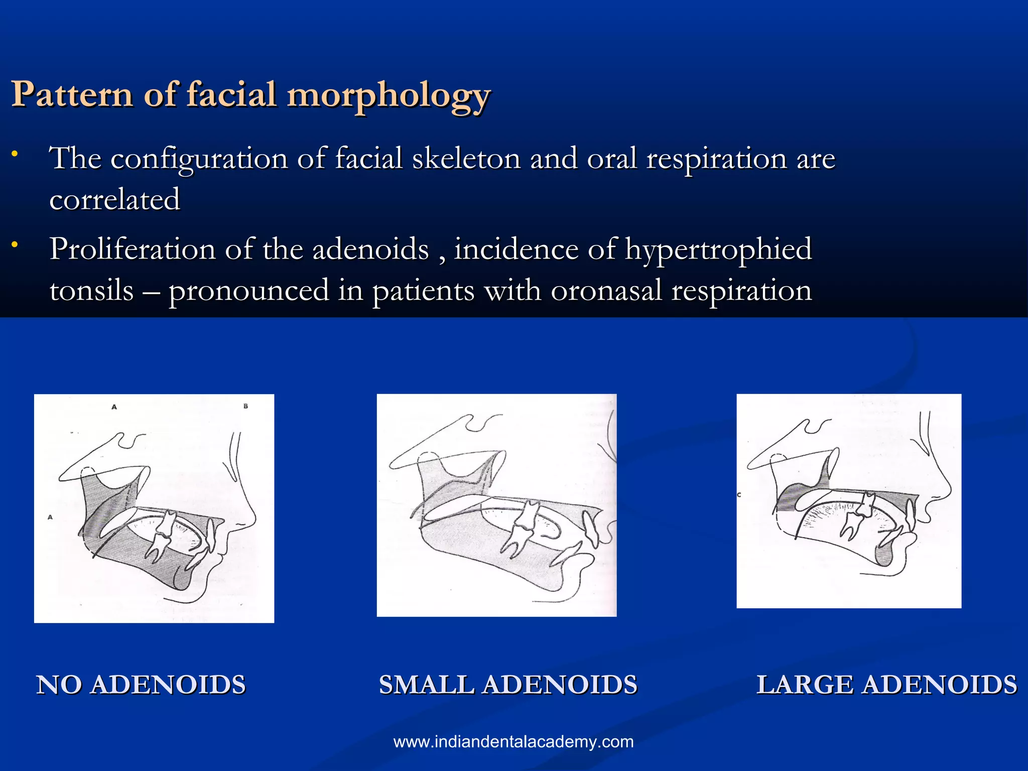 Pattern of facial morphologyPattern of facial morphology
• The configuration of facial skeleton and oral respiration areThe configuration of facial skeleton and oral respiration are
correlatedcorrelated
• Proliferation of the adenoids , incidence of hypertrophiedProliferation of the adenoids , incidence of hypertrophied
tonsils – pronounced in patients with oronasal respirationtonsils – pronounced in patients with oronasal respiration
NO ADENOIDSNO ADENOIDS LARGE ADENOIDSLARGE ADENOIDSSMALL ADENOIDSSMALL ADENOIDS
www.indiandentalacademy.com
 