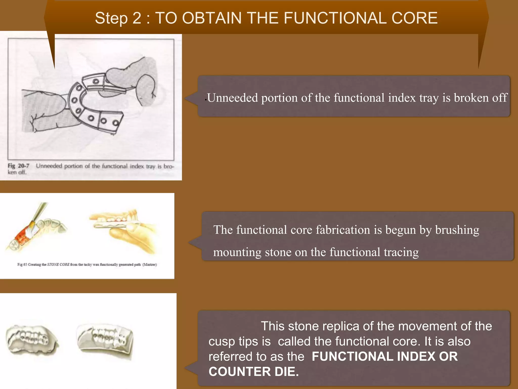 11
Step 2 : TO OBTAIN THE FUNCTIONAL CORE
•Unneeded portion of the functional index tray is broken off
The functional core fabrication is begun by brushing
mounting stone on the functional tracing
This stone replica of the movement of the
cusp tips is called the functional core. It is also
referred to as the FUNCTIONAL INDEX OR
COUNTER DIE.
 
