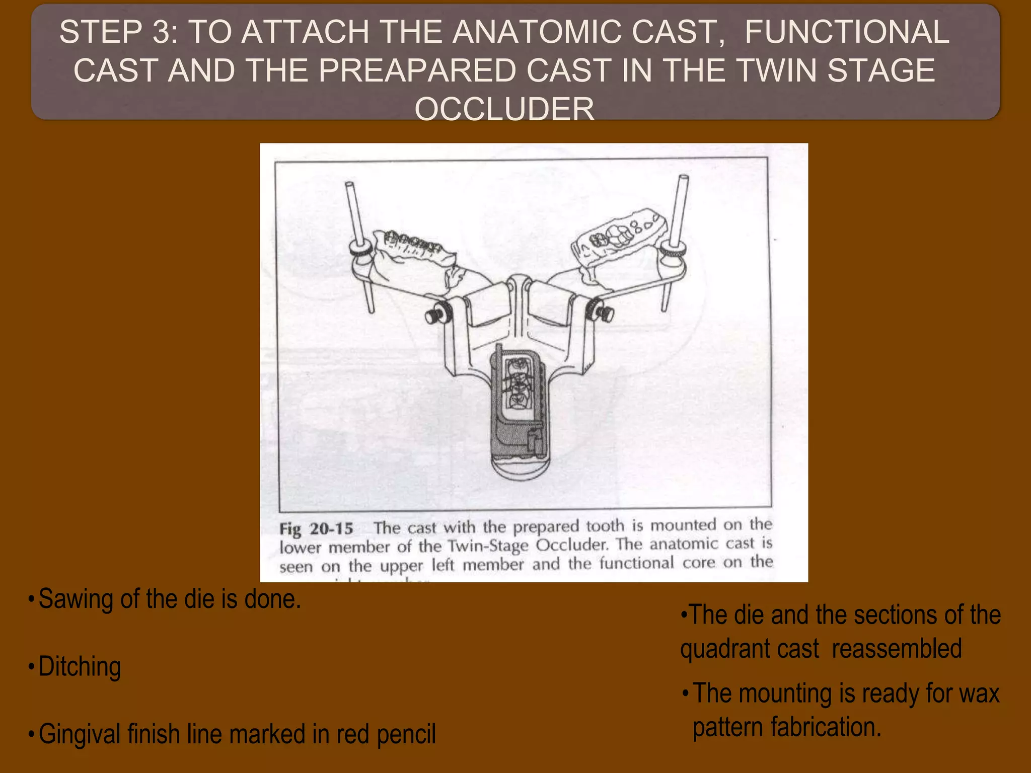 STEP 3: TO ATTACH THE ANATOMIC CAST, FUNCTIONAL
CAST AND THE PREAPARED CAST IN THE TWIN STAGE
OCCLUDER
•Sawing of the die is done.
•Ditching
•Gingival finish line marked in red pencil
•The die and the sections of the
quadrant cast reassembled
•The mounting is ready for wax
pattern fabrication.
 