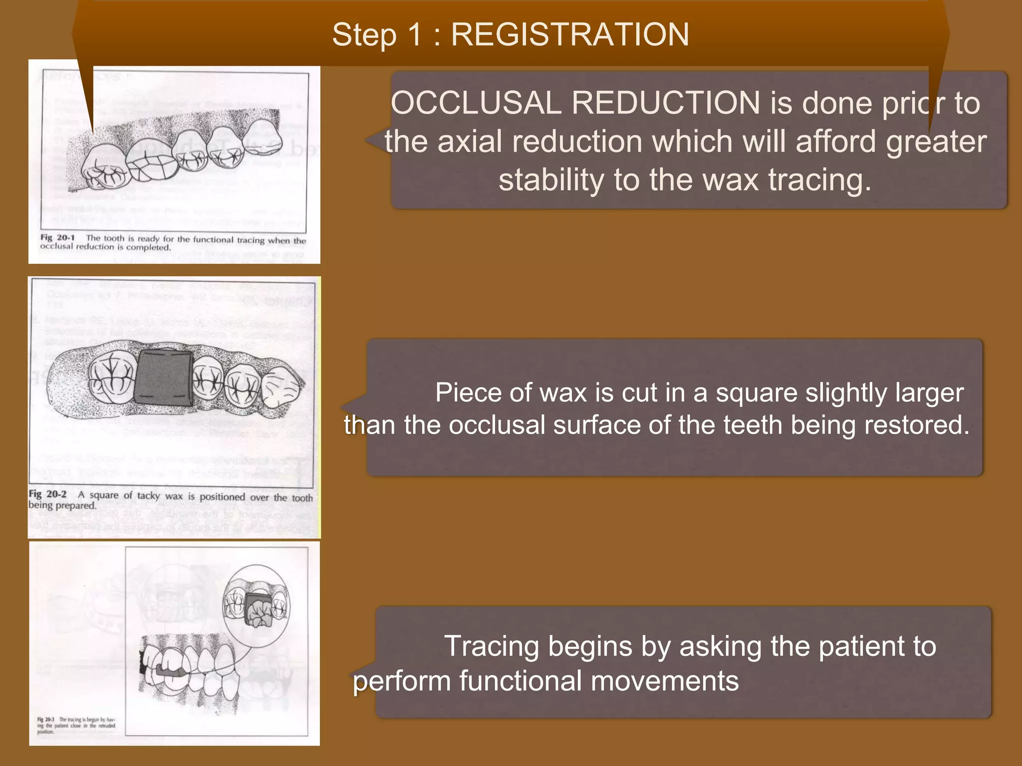 OCCLUSAL REDUCTION is done prior to
the axial reduction which will afford greater
stability to the wax tracing.
Piece of wax is cut in a square slightly larger
than the occlusal surface of the teeth being restored.
Tracing begins by asking the patient to
perform functional movements
Step 1 : REGISTRATION
 