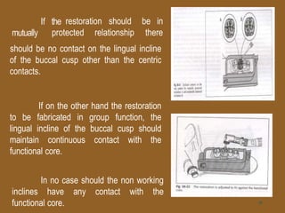 restoration should be inIf the
mutually protected relationship there
should be no contact on the lingual incline
of the buccal cusp other than the centric
contacts.
If on the other hand the restoration
to be fabricated in group function, the
lingual incline of the buccal cusp should
maintain continuous contact with the
functional core.
In no case should the non working
inclines have any contact with the
functional core. 36
 