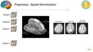 Functional Magnetic Resonance Imaging (FMRI) | PDF