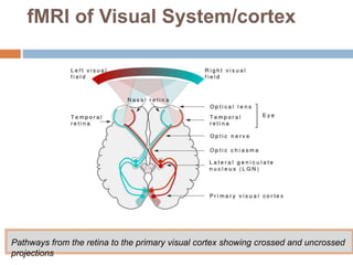 Functional magnetic resonance imaging-fMRI | PPTX