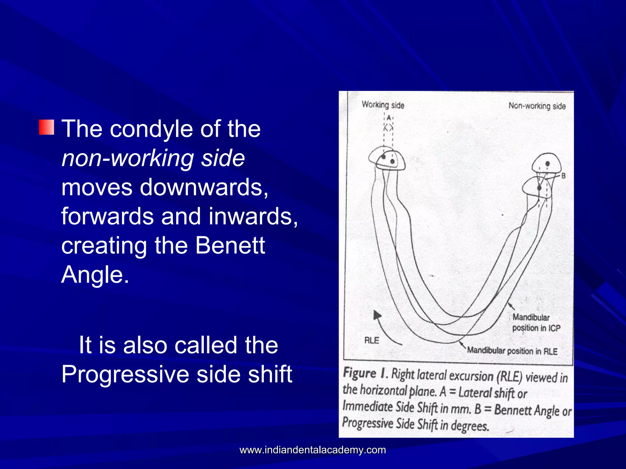 The condyle of the
non-working side
moves downwards,
forwards and inwards,
creating the Benett
Angle.
It is also called the
Progressive side shift
www.indiandentalacademy.com

 