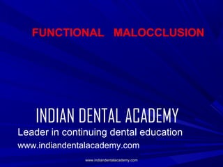 FUNCTIONAL MALOCCLUSION

INDIAN DENTAL ACADEMY
Leader in continuing dental education
www.indiandentalacademy.com
www.indiandentalacademy.com

 