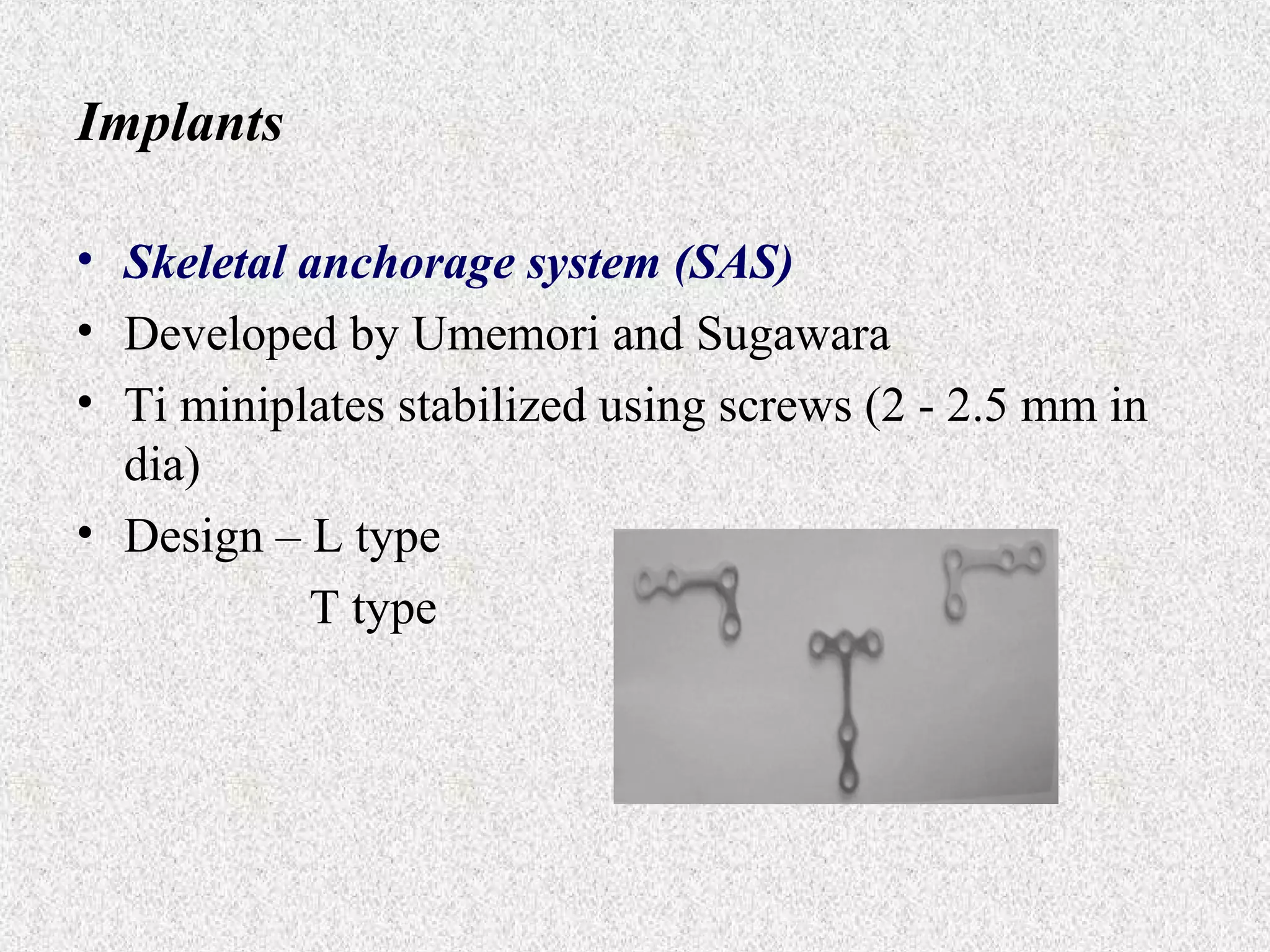 Implants
• Skeletal anchorage system (SAS)
• Developed by Umemori and Sugawara
• Ti miniplates stabilized using screws (2 - 2.5 mm in
dia)
• Design – L type
T type

 