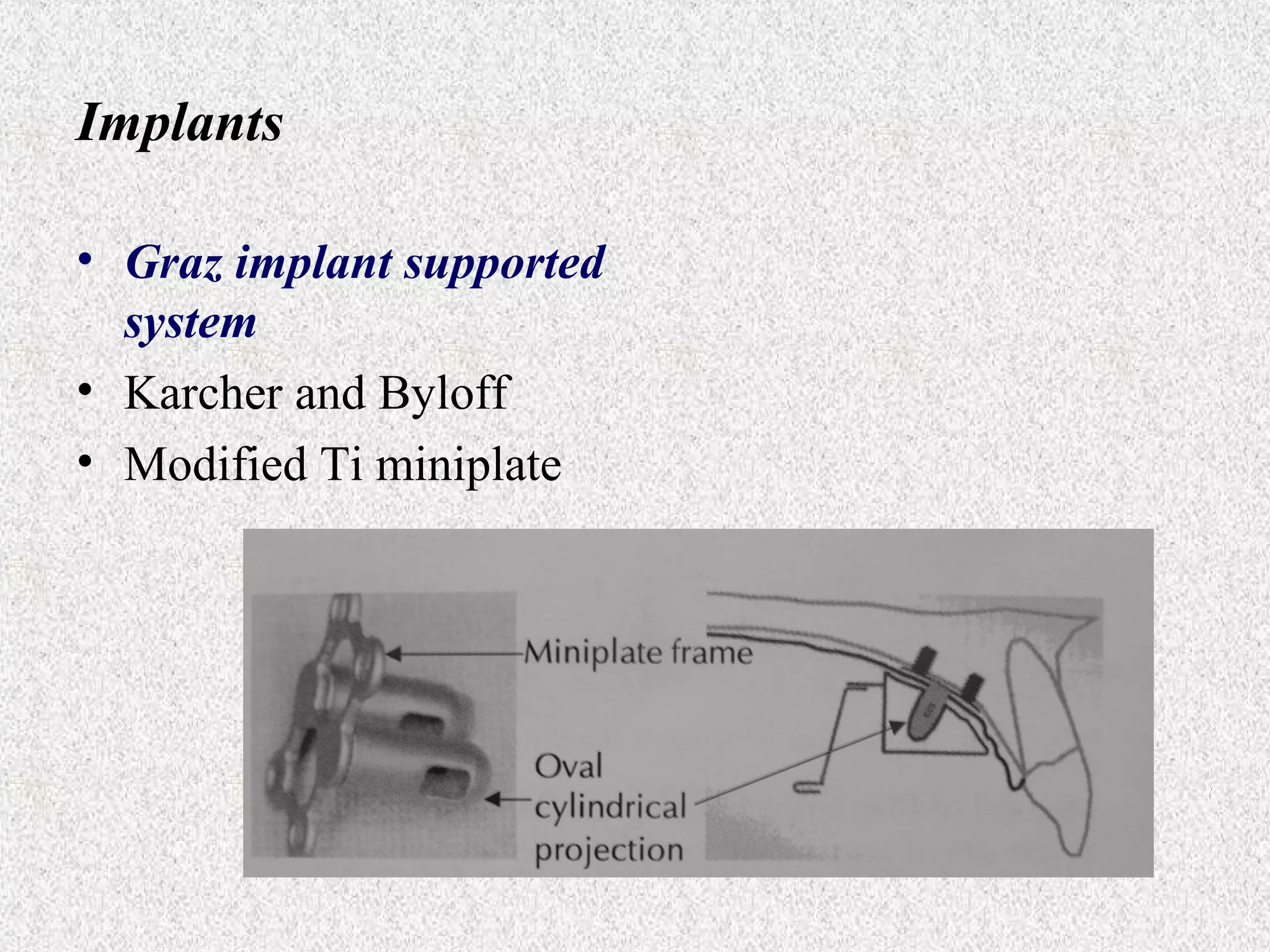 Implants
• Graz implant supported
system
• Karcher and Byloff
• Modified Ti miniplate

 