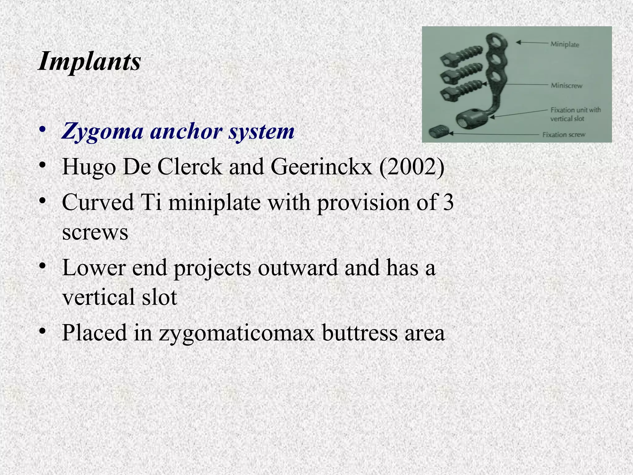 Implants
• Zygoma anchor system
• Hugo De Clerck and Geerinckx (2002)
• Curved Ti miniplate with provision of 3
screws
• Lower end projects outward and has a
vertical slot
• Placed in zygomaticomax buttress area

 