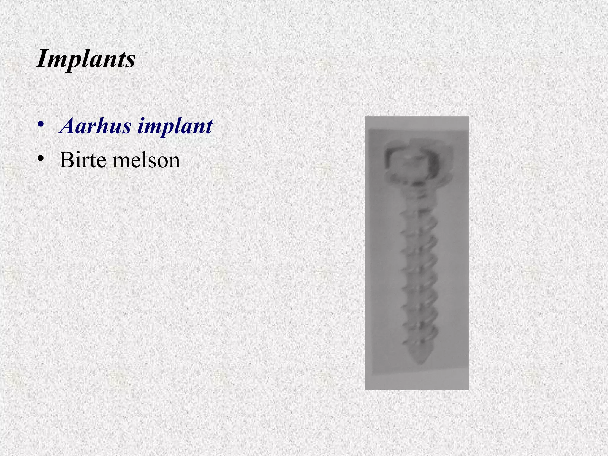 Implants
• Aarhus implant
• Birte melson

 