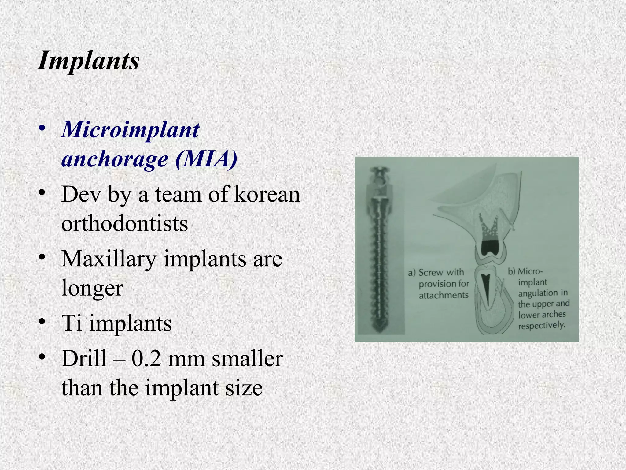 Implants
• Microimplant
anchorage (MIA)
• Dev by a team of korean
orthodontists
• Maxillary implants are
longer
• Ti implants
• Drill – 0.2 mm smaller
than the implant size

 