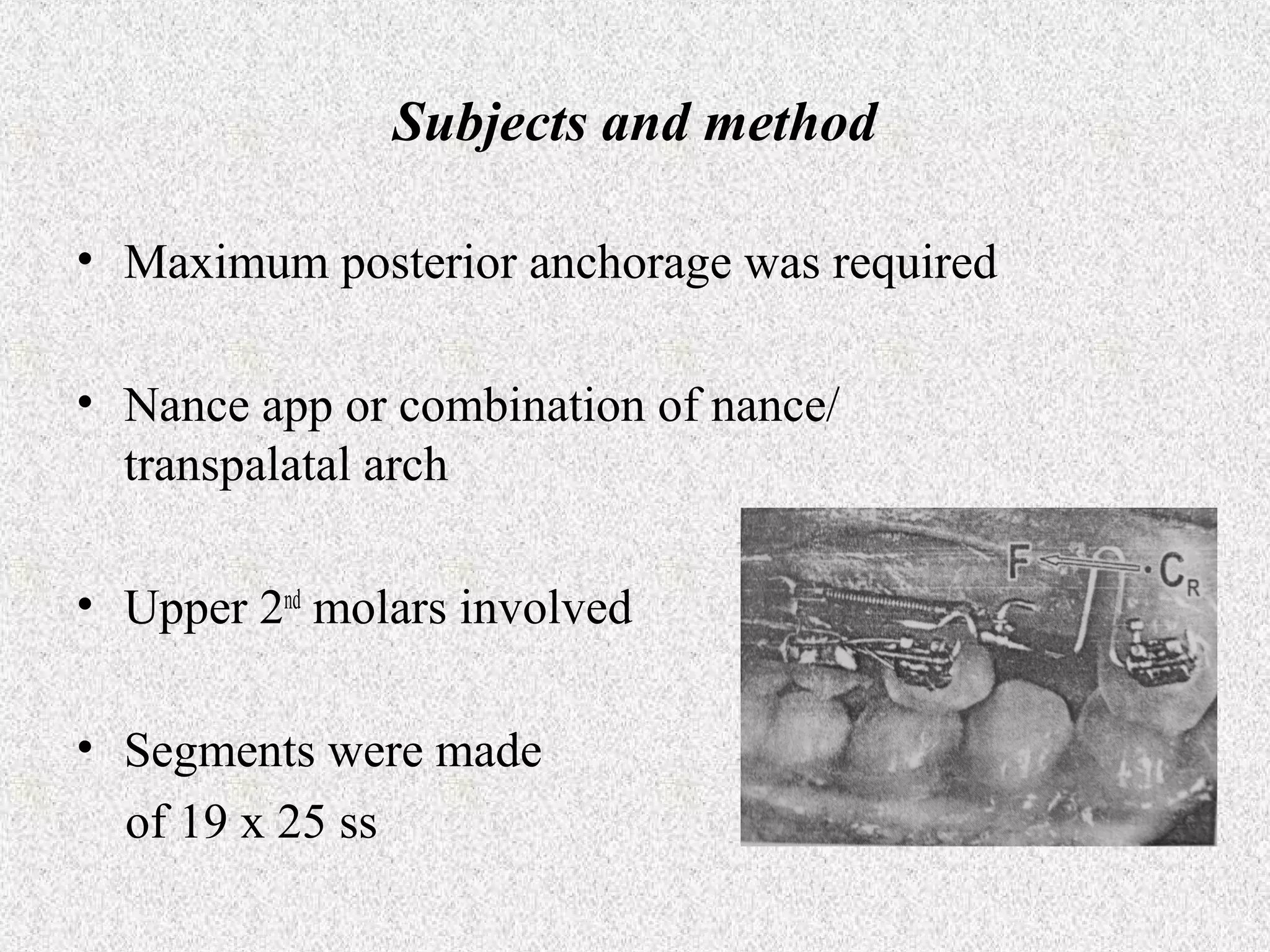 Subjects and method
• Maximum posterior anchorage was required
• Nance app or combination of nance/
transpalatal arch
• Upper 2nd molars involved
• Segments were made
of 19 x 25 ss

 