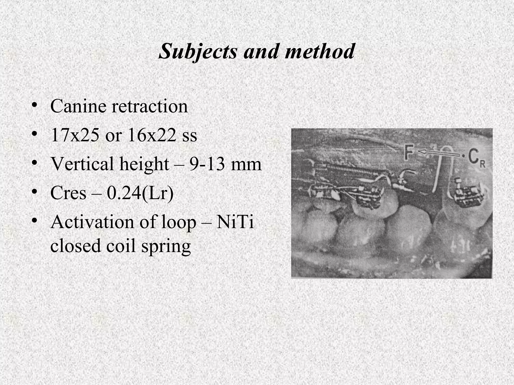 Subjects and method
•
•
•
•
•

Canine retraction
17x25 or 16x22 ss
Vertical height – 9-13 mm
Cres – 0.24(Lr)
Activation of loop – NiTi
closed coil spring

 